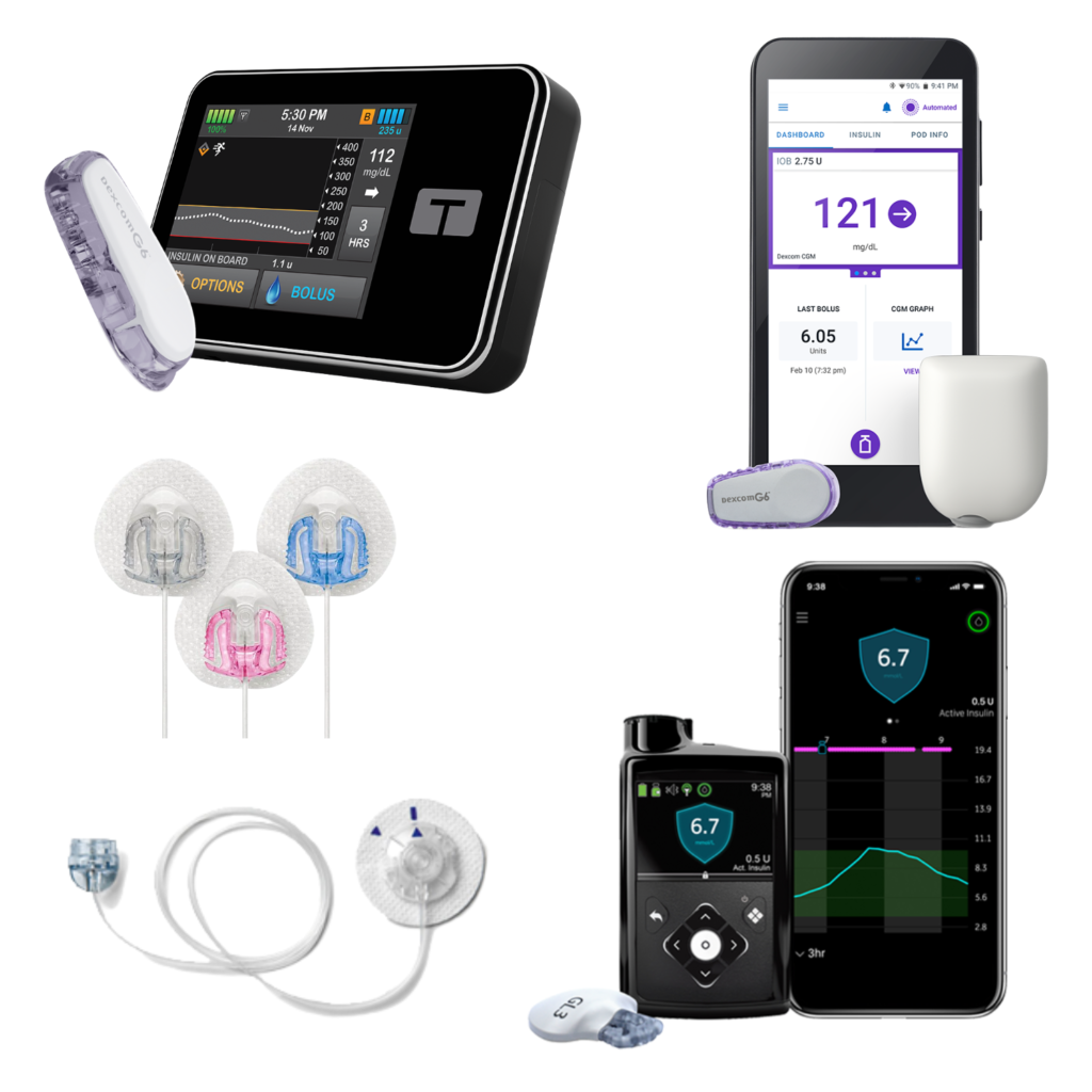 Diabetes Insulin Pump 101 & Top Brands Milk & Honey Nutrition