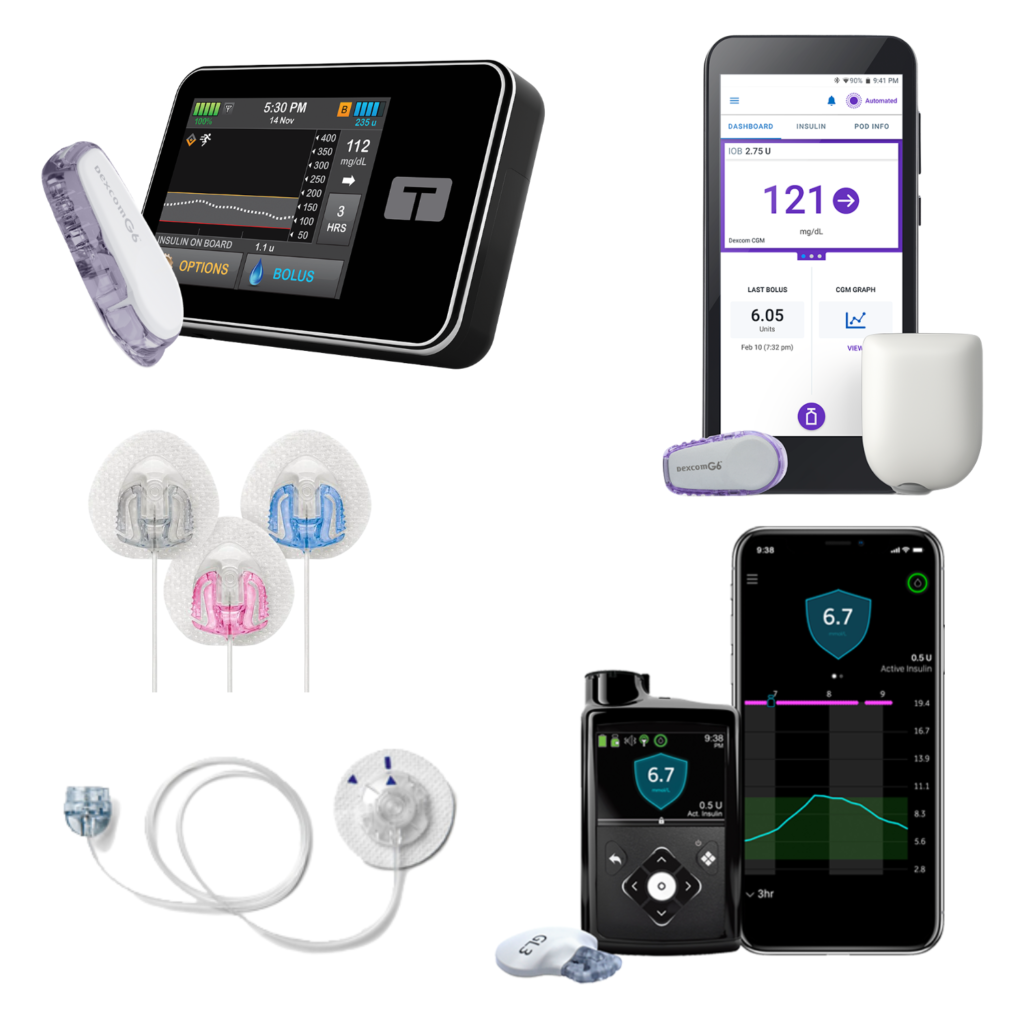 top diabetes insulin pump option comparison