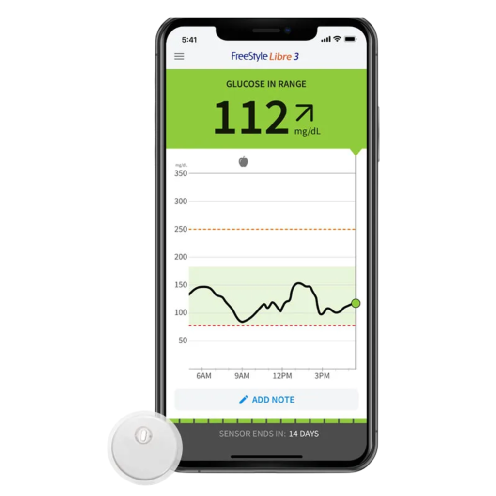 Comparing Top Glucose Monitoring Devices