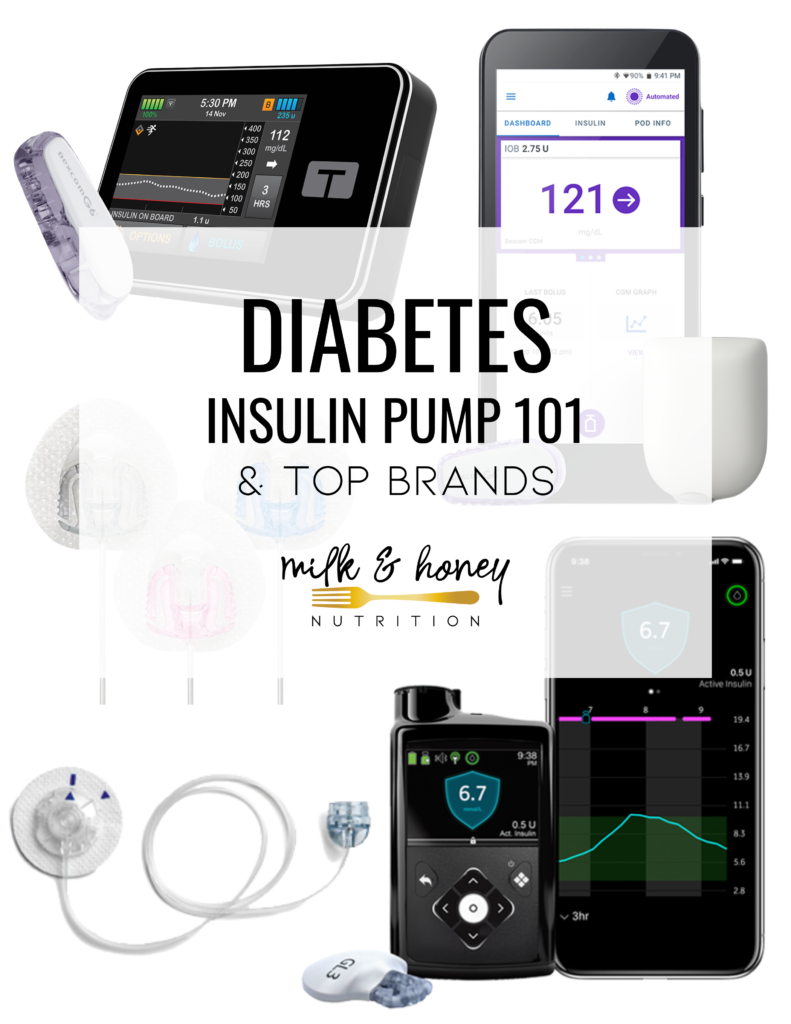 top diabetes insulin pump options