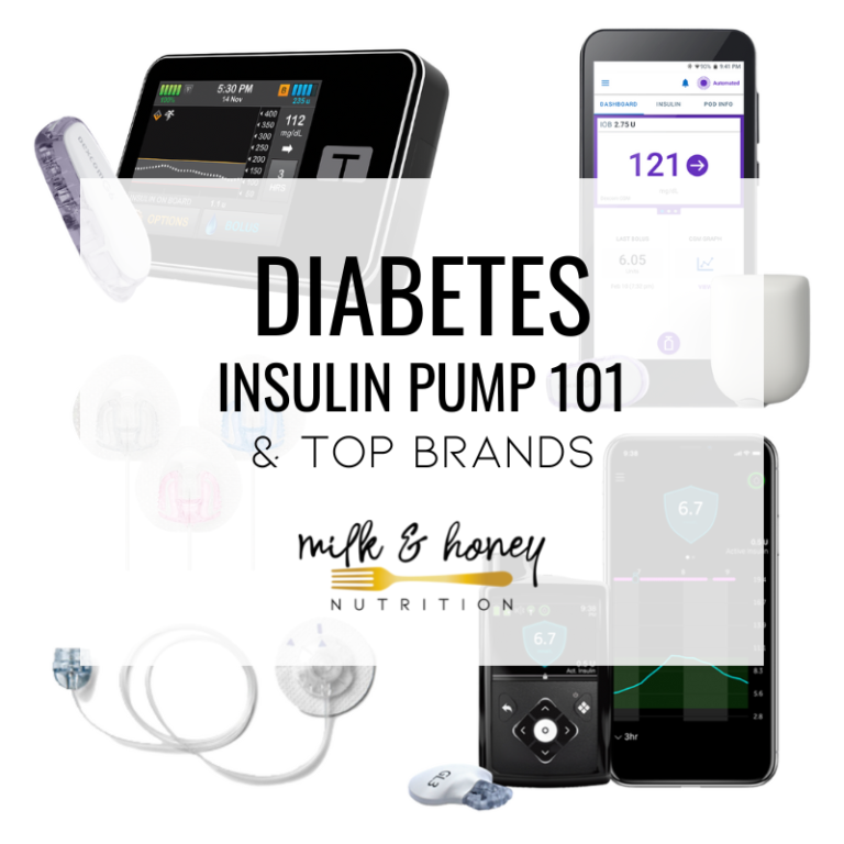 top diabetes insulin pump options