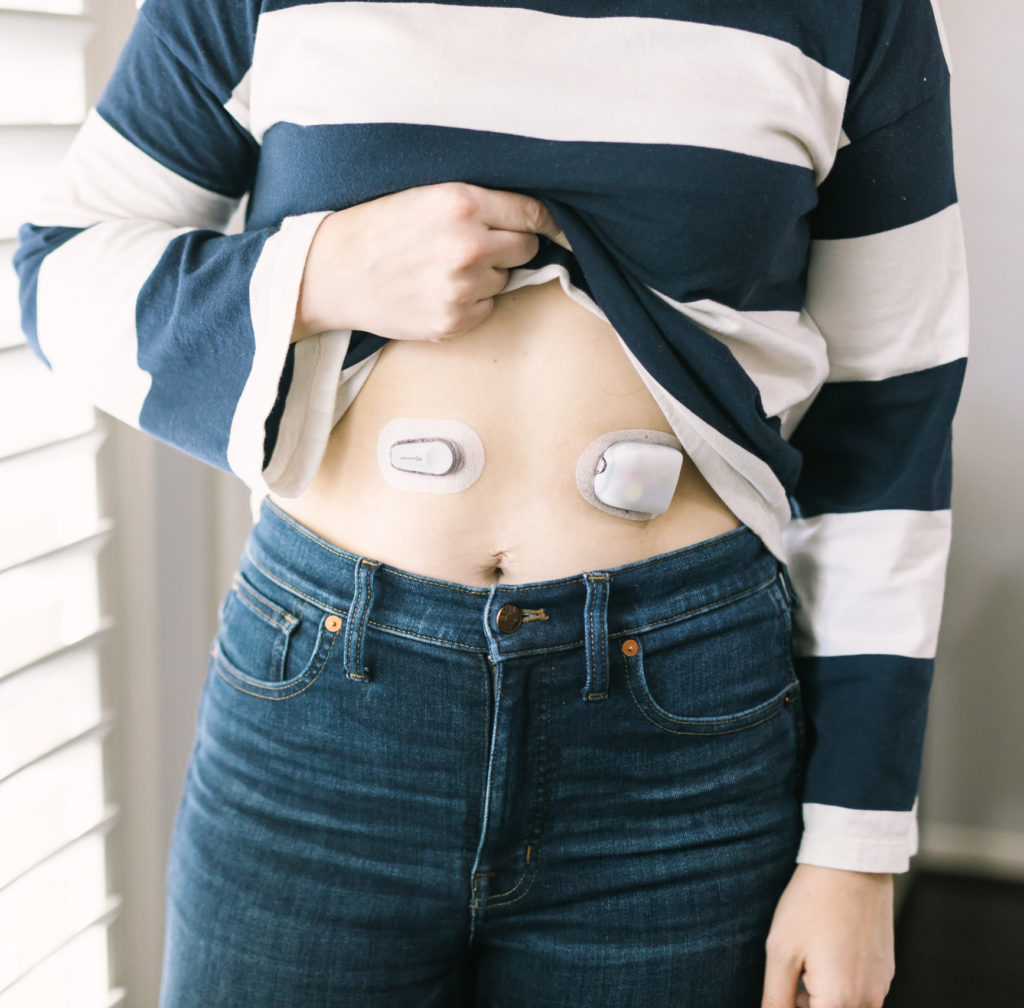 woman with dexcom and omnipod