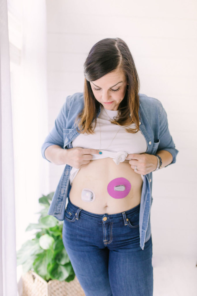 Supporting someone with diabetes 2 | Milk & Honey Nutrition woman with diabetes wearing insulin pump and dexcom
