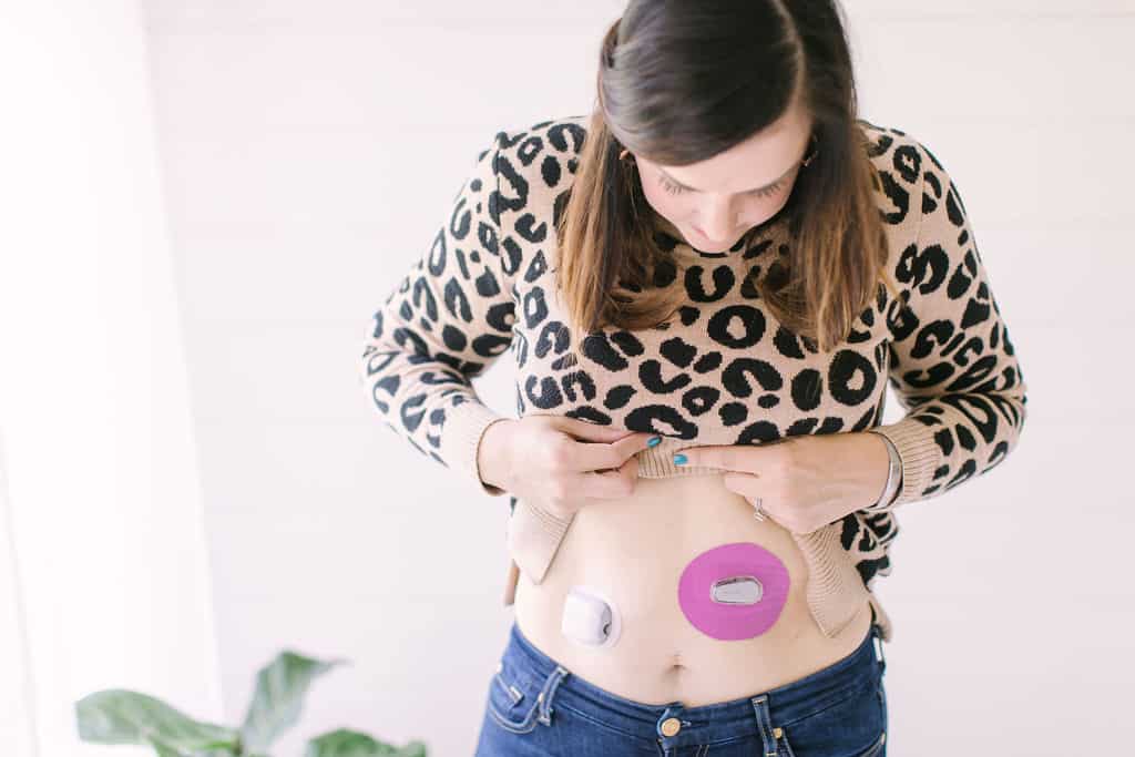 woman with diabetes devices dexcom omnipod different types of diabetes