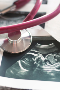 pink stethoscope and sonogram